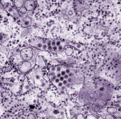 dengue virus particles dengue virus particles