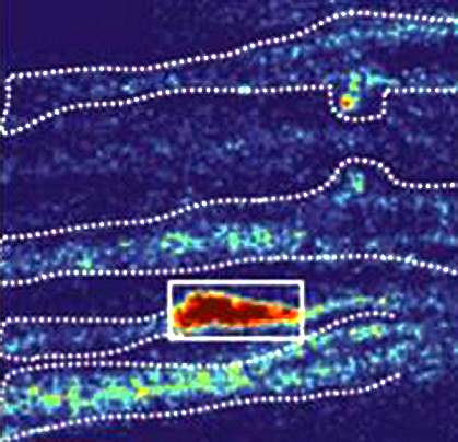 Microscope image showing several nerve fibers, one with a bright fluorescent signal. Microscope image showing several nerve fibers, one with a bright fluorescent signal.
