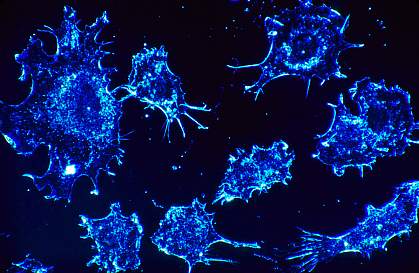 Cancer cells Cancer cells