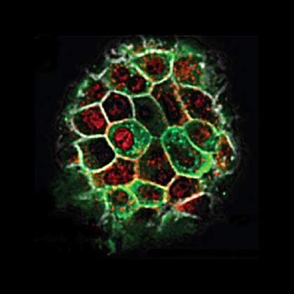 Confocal microscope image showing mass of cells with green and red areas Confocal microscope image showing mass of cells with green and red areas.