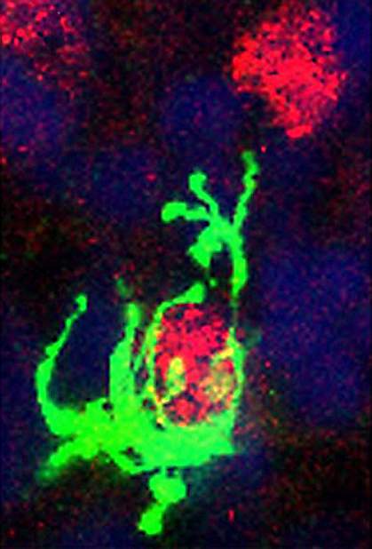 Confocal micrograph of a microglial cell engulfing a neural precursor cell. Confocal micrograph of a microglial cell engulfing a neural precursor cell.