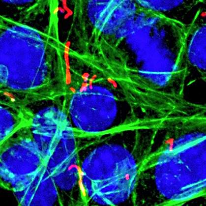 Strand-like bacteria inside cells Strand-like bacteria inside cells.
