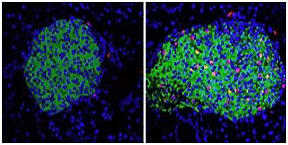 Pancreatic beta cells Pancreatic beta cells.