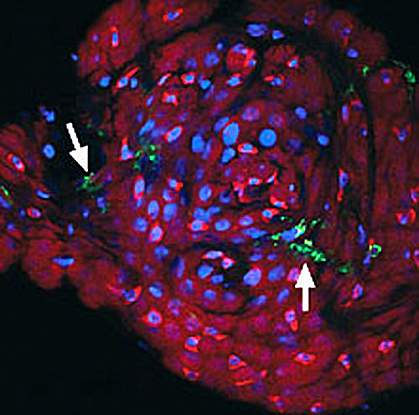 Wolbachia in a mosquito Wolbachia in a mosquito.