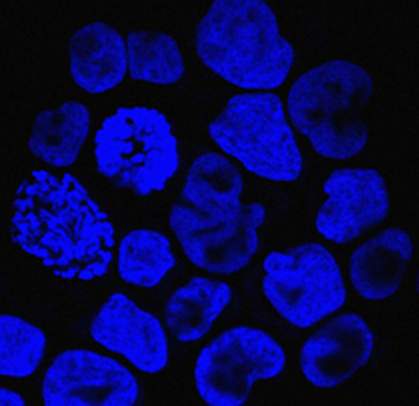 T cells T cells.