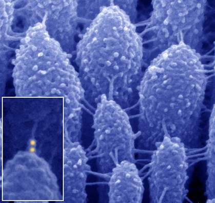 Micrograph of inner ear hair cells Micrograph of inner ear hair cells