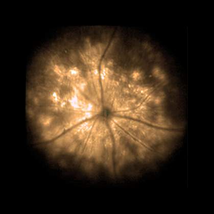 A mouse retina A mouse retina.