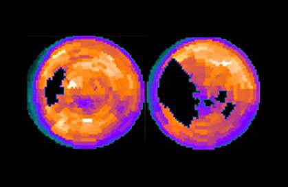 Computer generated map of two hearts Computer generated map of two hearts