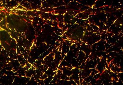 Mouse brain cells Mouse brain cells.