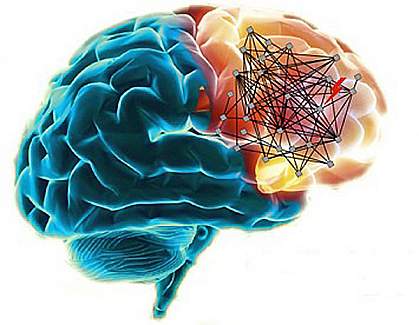 Schizophrenia networks in the human brain Schizophrenia networks in the human brain.