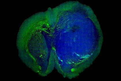 Tumor in a mouse brain Tumor in a mouse brain.