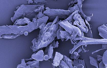 House dust, shown under high magnification House dust, shown under high magnification.
