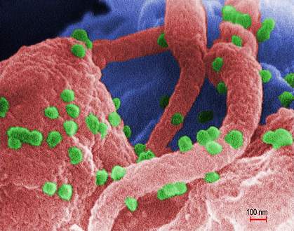 HIV on a human lymphocyte.