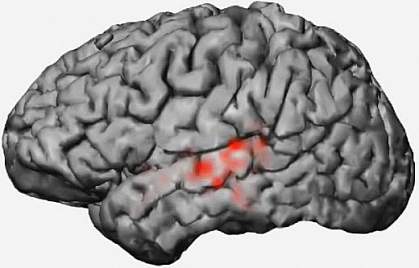 Electrical patterns in a brain Electrical patterns in a brain.