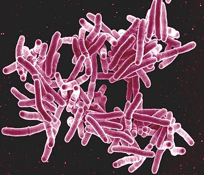 A group of strand-like bacteria A group of strand-like bacteria.