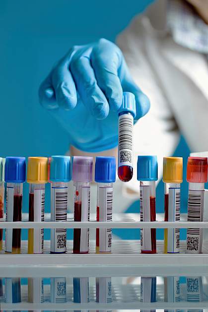 Scientist taking a blood sample tube from a rack Scientist taking a blood sample tube from a rack.