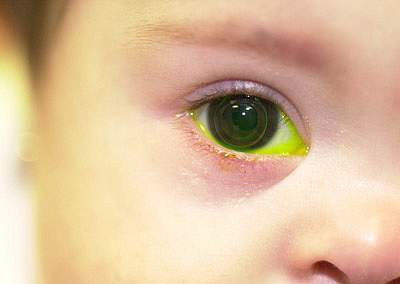 A child's eye A child's eye.