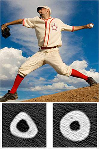 A baseball pitcher throwing, with cross-sections underneath of bigger bone under the throwing arm and smaller bone under the non-throwing arm A baseball pitcher throwing, with cross-sections underneath of bigger bone under the throwing arm and smaller bone under the non-throwing arm.