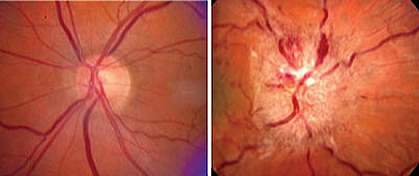 The inside of a human eye The inside of a human eye.