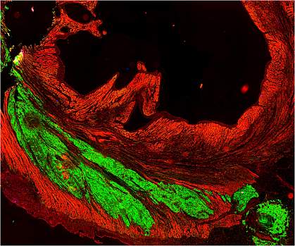 Microscopic image of heart muscle, with large fluorescent green areas among red Microscopic image of heart muscle, with large fluorescent green areas among red.