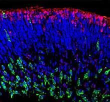 Induced pluripotent stem cells form a structure with layers of cells Induced pluripotent stem cells form a structure with layers of cells.