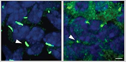 Cilia in liver cells.