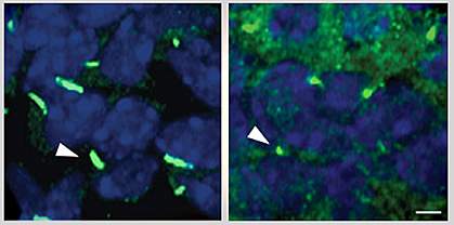 Cilia in liver cells Cilia in liver cells.