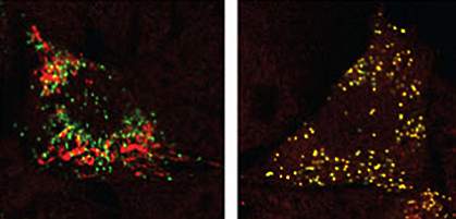 Kidney cells Kidney cells