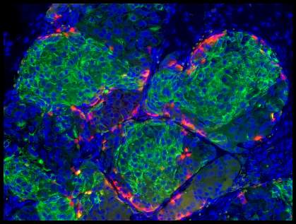 Human stem cell-derived beta cells Human stem cell-derived beta cells.