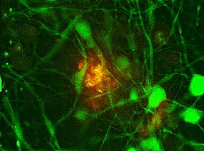 Neurons Neurons