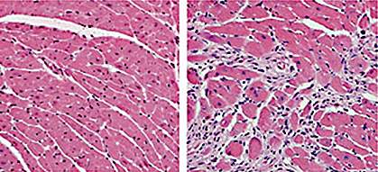 Heart tissue Heart tissue