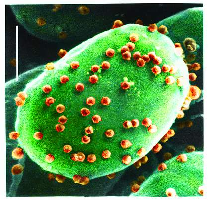Alga infected with a chlorovirus Alga infected with a chlorovirus.
