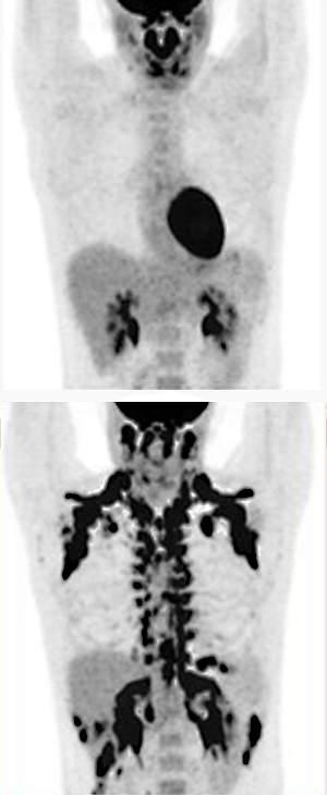 PET scans of human participants PET scans of human participants