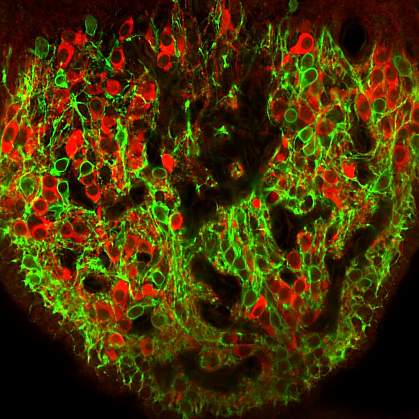 Mouse brain cells colored red and green Mouse brain cells colored red and green.