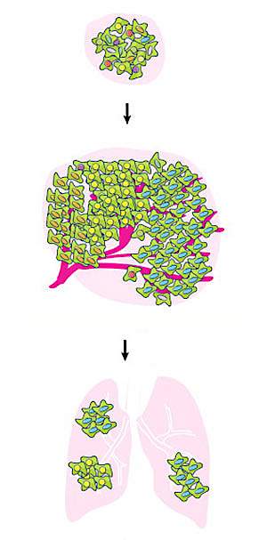 Illustration of cells in a tumor Illustration of cells in a tumor.