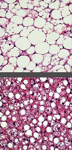 Fat cells Image of fat cells taken through a microscope.