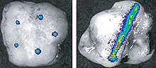 Scans of injection devices in tumors Scans of injection devices in tumors.