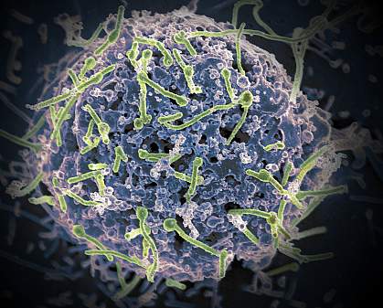 Ebola virus on a cell culture Ebola virus on a cell culture.