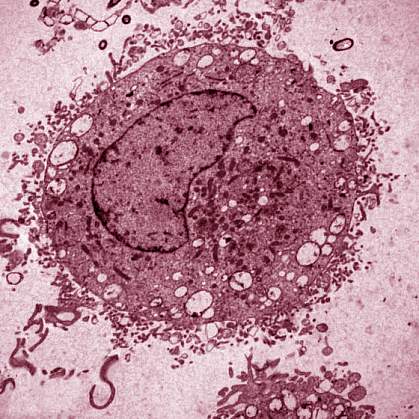 Mast cell Mast cell.