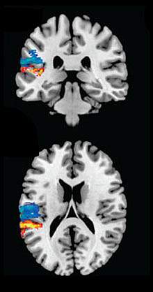 Brain Images Brain Images