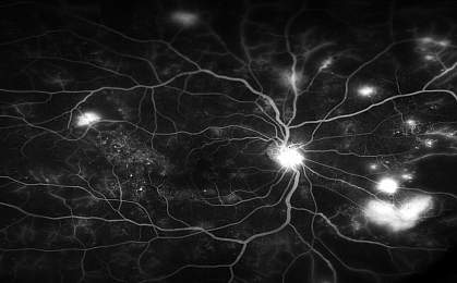 Retinal Blood Vessels Retinal Blood Vessels.