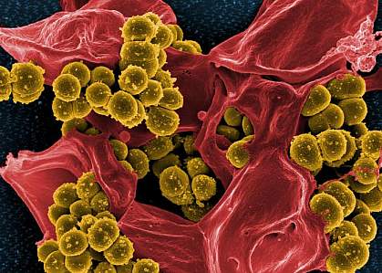 MRSA MRSA.
