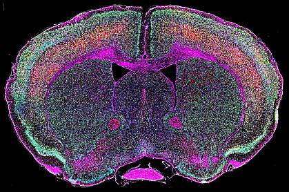Mouse brain expressing env Mouse brain expressing env.