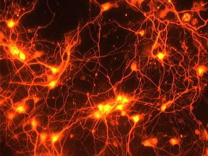 Neurons Neurons.