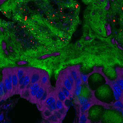 Mice fed emulsifiers Mice fed emulsifiers had bacteria (red) deep in the mucus layer (green) so they were closer to intestinal cells (purple and blue) than they should be.