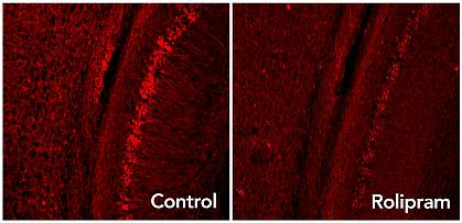Rolipram panel has less bright red dots than control panel. Brain images show rolipram panel with less bright red dots than control panel.