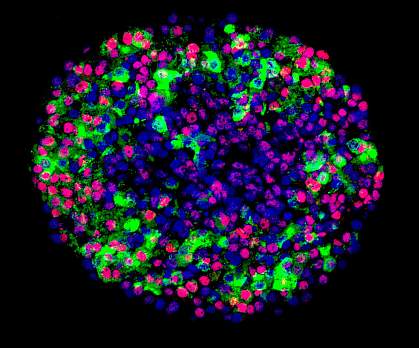 Cells in alginate capsule