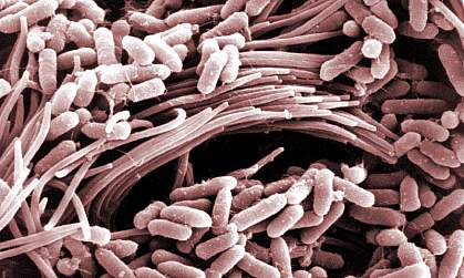 Bacteria in airway affected by cystic fibrosis Bacteria in airway affected by cystic fibrosis