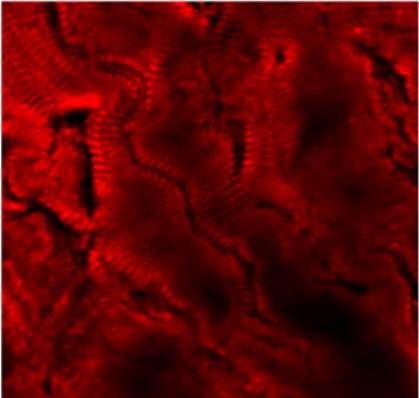 Mouse heart muscle Mouse heart muscle