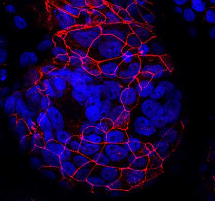 Fused trophoblasts Fused trophoblasts